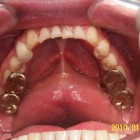 DB008 thumbnail