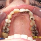 DM003 thumbnail