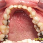 DM004 thumbnail