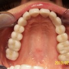 DM011 thumbnail