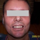 JE001 thumbnail