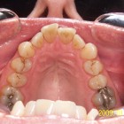 JE005 thumbnail