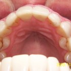 JE013 thumbnail