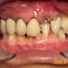 LSY001 thumbnail