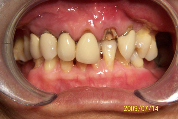 LSY001