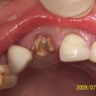 LSY002 thumbnail