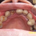 LSY002A thumbnail