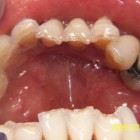 LSY003 thumbnail