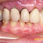 LSY004 thumbnail
