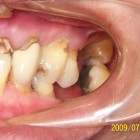 LSY006 thumbnail