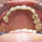 LSY008 thumbnail