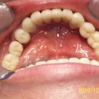 LSY009 thumbnail