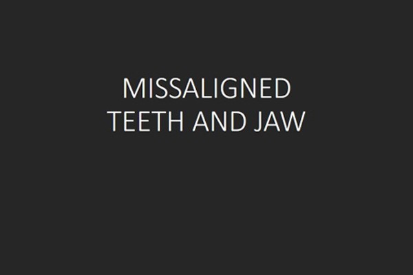 Misaligned
