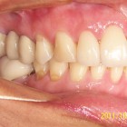 NM05 thumbnail